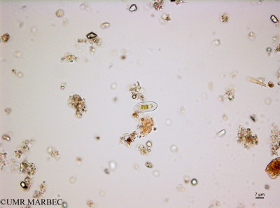 phyto/Bizerte/bizerte_bay/RISCO February 2015/Diploneis spp (ancien Baie_T5_CWD2_Diploneis160128_001_ovl-2).tif(copy)_thumb.jpg